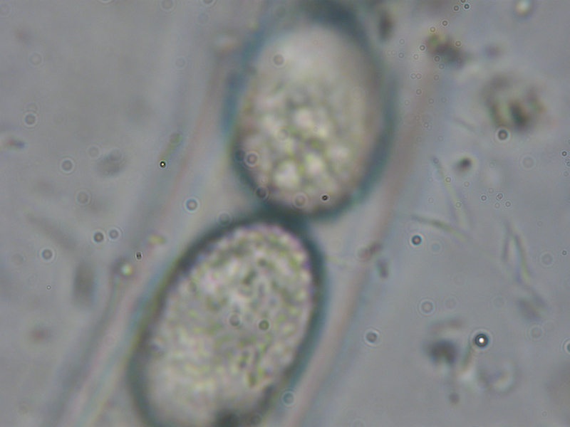 Mixomiceti con Scutellinia